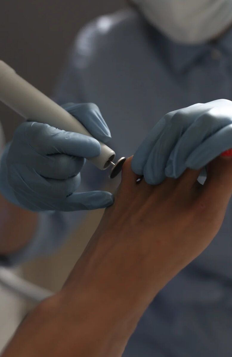 کالوس تراپی (کف سابی پا)